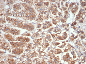 IL18 Antibody