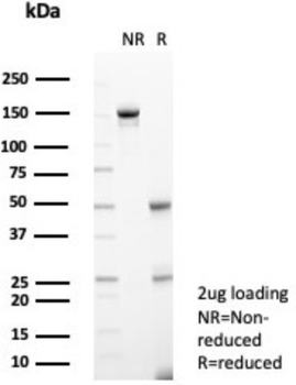 IL1RN Antibody