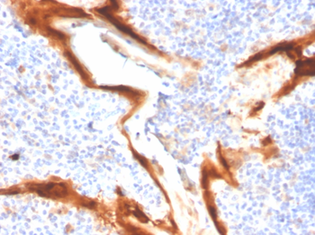 IL1RN Antibody