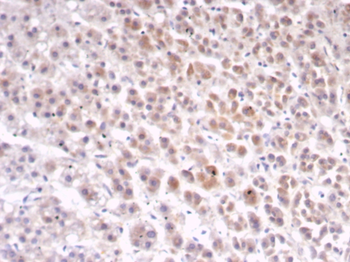 IL1RN Antibody