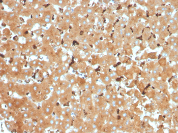 HP Antibody