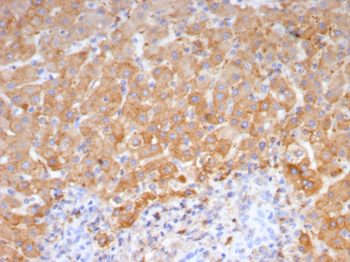 HP Antibody