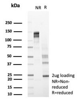 HEXB Antibody