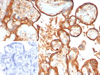 HEXB Antibody