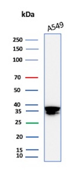 ANXA1 Antibody