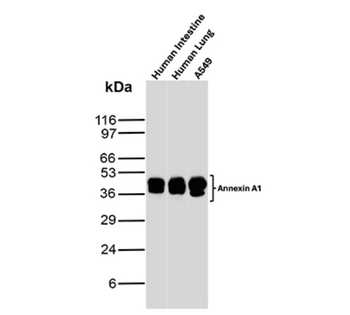 ANXA1 Antibody