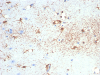 GFAP Antibody