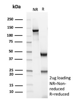 GFAP Antibody