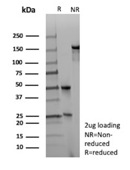 GFAP Antibody