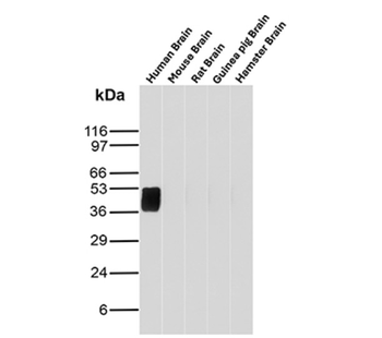 GFAP Antibody