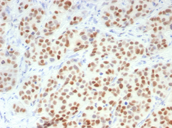 GATA3 Antibody