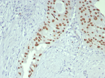 GATA3 Antibody