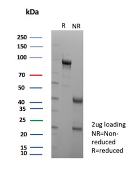 ENO2 Antibody