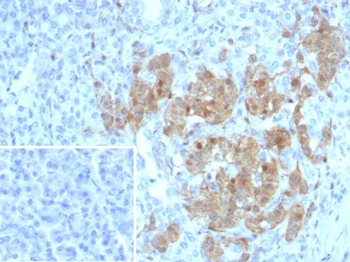 ENO2 Antibody