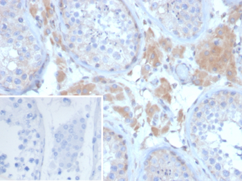 GDF9 Antibody