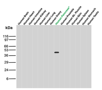 CPA1 Antibody