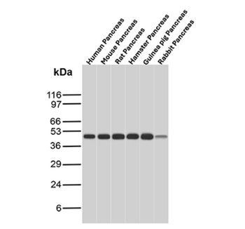 CPA1 Antibody