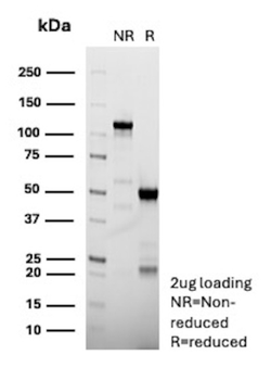 CNN1 Antibody