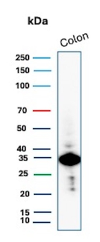 CNN1 Antibody