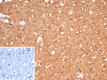 CKB Antibody