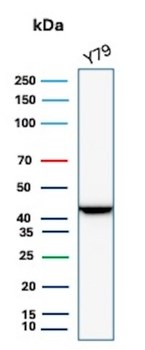 CKB Antibody