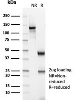 CKB Antibody