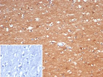 CKB Antibody