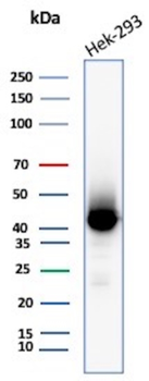 CKB Antibody