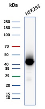 CKB Antibody