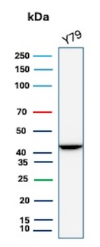 CKB Antibody