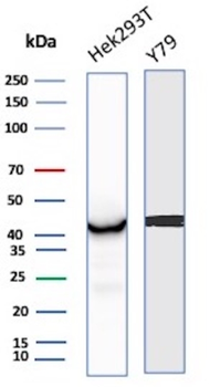 CKB Antibody