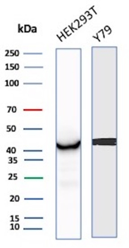 CKB Antibody