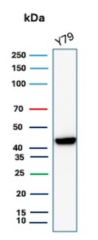 CKB Antibody