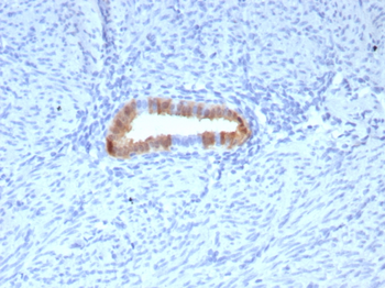 CDKN2A Antibody