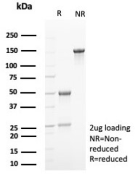 CDKN2A Antibody