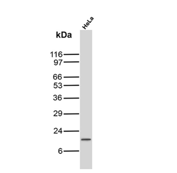 CDKN2A Antibody