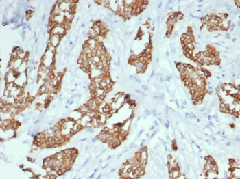 NTRK3 Antibody