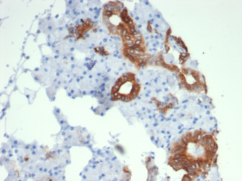 NTRK3 Antibody