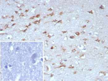 NTRK2 Antibody