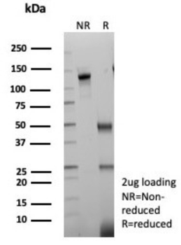 NTRK2 Antibody