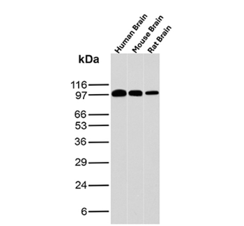 NTRK2 Antibody