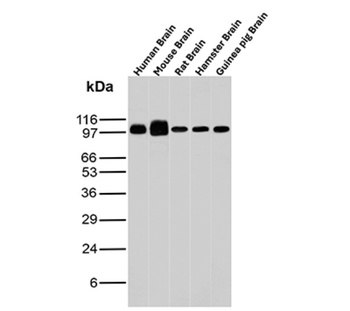 NTRK2 Antibody