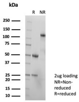 Recombinant TAG-72 / CA72.4 (Tumor-Associated Glycoprotein) Antibody
