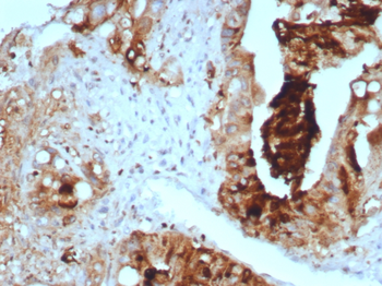 Recombinant TAG-72 / CA72.4 (Tumor-Associated Glycoprotein) Antibody