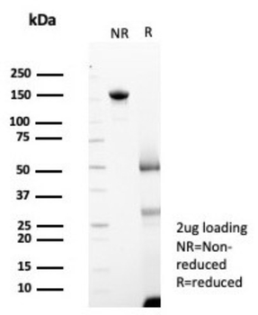 TMPRSS2 Antibody