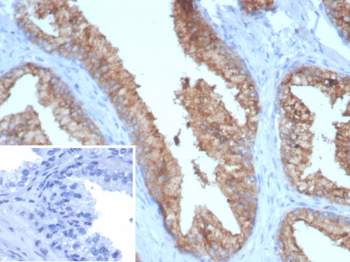 TMPRSS2 Antibody