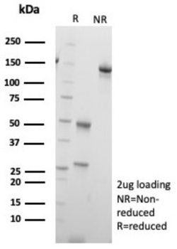 SLC18A2 Antibody