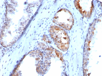 SLC18A2 Antibody