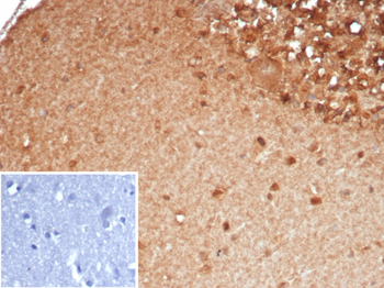 SLC18A2 Antibody