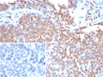 Recombinant Double Stranded DNA (dsDNA) (Nuclear Marker) Antibody